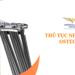 thu tuc nhap khau osteonic