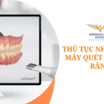 thu tuc nhap khau may quet lay dau rang