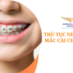 thu tuc nhap khau mac cai chinh nha