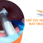 thu tuc nhap khau may tram rang