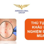 THỦ TỤC NHẬP KHẨU BỘ XÉT NGHIỆM BỆNH ĐẬU MÙA KHỈ