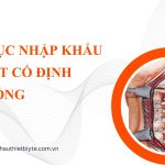 THỦ TỤC NHẬP KHẨU NẸP VÍT CỐ ĐỊNH CỘT SỐNG