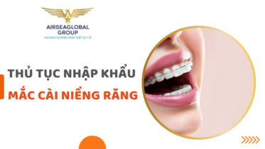 mắc cài niềng răng