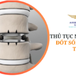THỦ TỤC NHẬP KHẨU ĐỐT SỐNG NHÂN TẠO