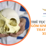 THỦ TỤC NHẬP KHẨU ĐỐT SỐNG NHÂN TẠO