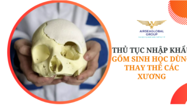 THỦ TỤC NHẬP KHẨU ĐỐT SỐNG NHÂN TẠO