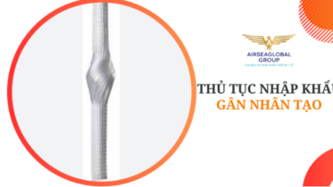 THỦ TỤC NHẬP KHẨU GÂN NHÂN TẠO