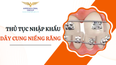 dây cung niềng răng