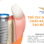 thu tuc nhap khau chan rang nhan tao