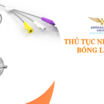 thu tuc nhap khau bong lay soi