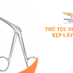 thu tuc nhap khau kep lay di vat