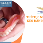 thu tuc nhap khau keo dan nha khoa