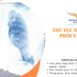 thu tuc nhap khau phim x quang