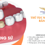 thu tuc nhap khau rang su