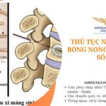 thu tuc nhap khau bong nong than dot song