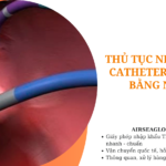 thu tuc nhap khau catheter cat dot bang nhiet