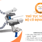 thu tuc nhap khau bo co dinh mom tim