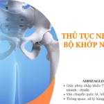 thu tuc nhap khau bo khop nhan tao