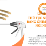 thu tuc nhap khau bang ghim cat khau noi noi soi
