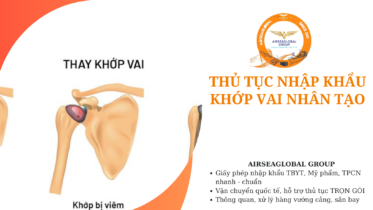 thu tuc nhap khau khop vai nhan tao
