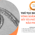 thu tuc nhap khau vong xoan kim loai bit tui phinh mach nao phu gel