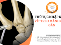 thu tuc nhap khau vit treo manh ghep gan