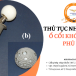 thu tuc nhap khau o coi khop hang phu ha