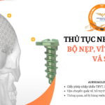 thu tuc nhap khau bo nep vit va luoi va so