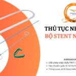thu tuc nhap khau bo stent nieu quan