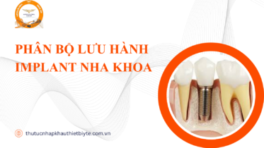 Phân bộ lưu hành implant nha khoa đúng bản chất pháp lý