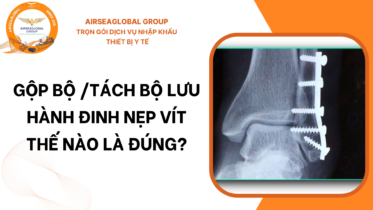TÁCH GỘP NẸP VÍT