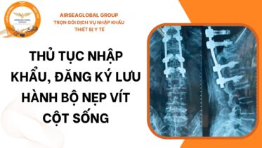 nẹp vít cột sống