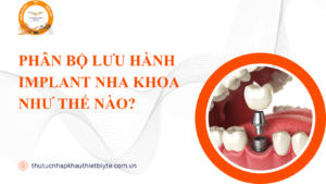 Phân bộ lưu hành implant nha khoa đúng bản chất giúp hồ sơ ra số nhanh và tránh bị tách bộ