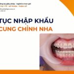THỦ TỤC NHẬP KHẨU DÂY CUNG CHỈNH NHA MỚI NHẤT 2026
