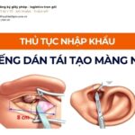 THỦ TỤC NHẬP KHẨU MIẾNG DÁN TÁI TẠO MÀNG NHĨ MỚI NHẤT 2026
