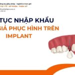 THỦ TỤC NHẬP KHẨU RĂNG GIẢ PHỤC HÌNH TRÊN IMPLANT MỚI NHẤT 2026